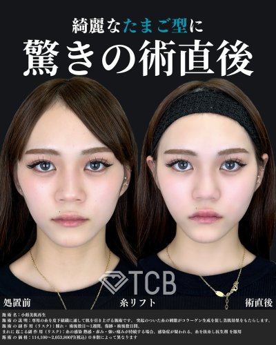 Carousel post from tcb_yamamoto.