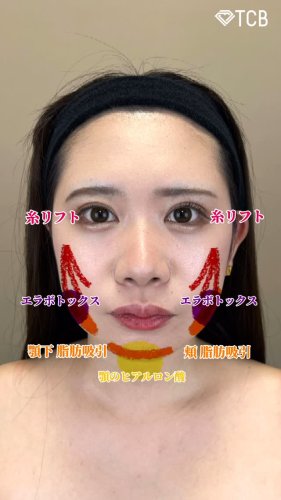 Video post from tcb_kamata.