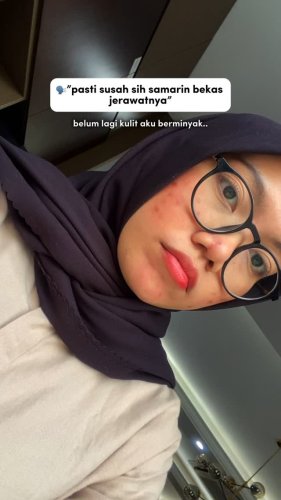 PostPhoto