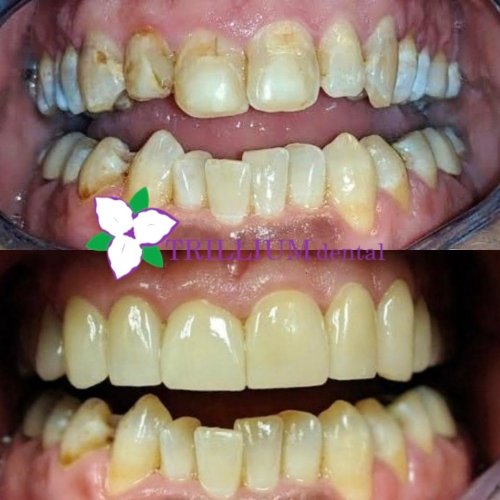 Photo post from trilliumdental.