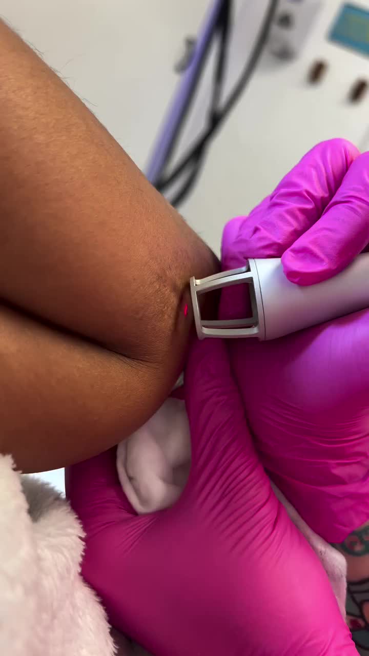 Video post from richbichclinic.