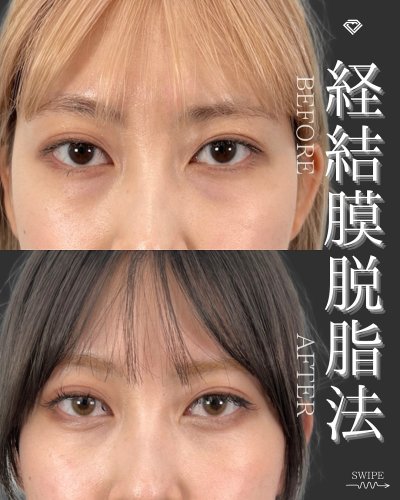 Carousel post from tcb_watanabe.shiori.