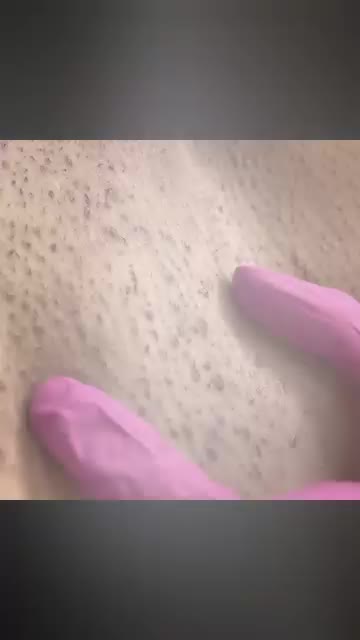 Video post from richbichclinic.