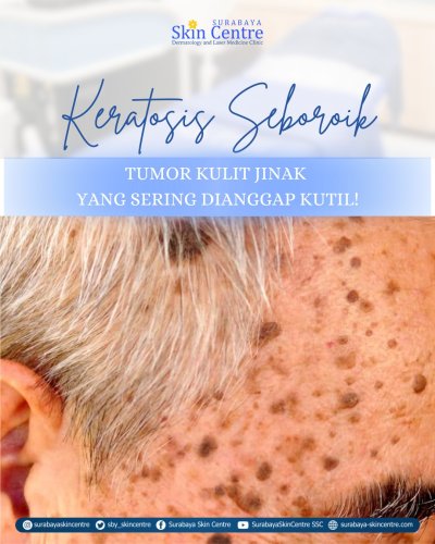 PostPhoto