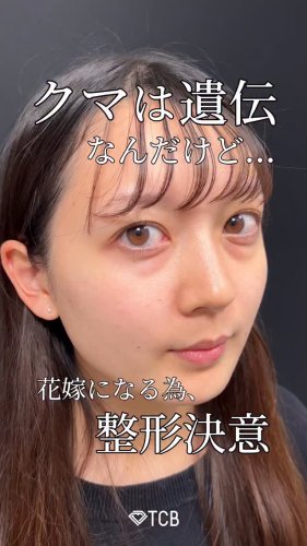 Video post from tcb_terato.