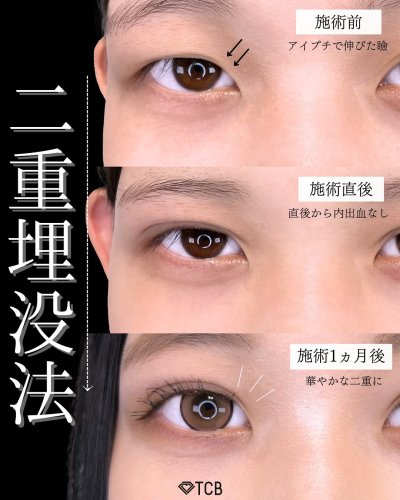 Carousel post from tcb_hirao.