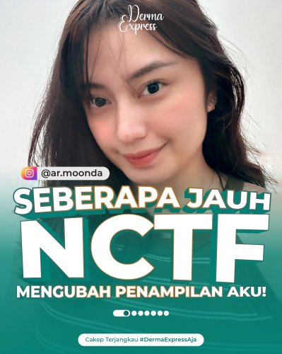 PostPhoto