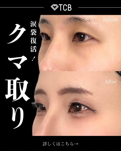 Carousel post from tcb_koga_tadanori.