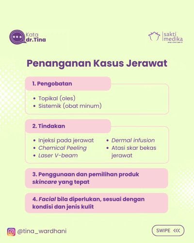 PostPhoto