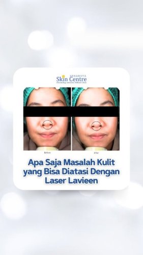 PostPhoto