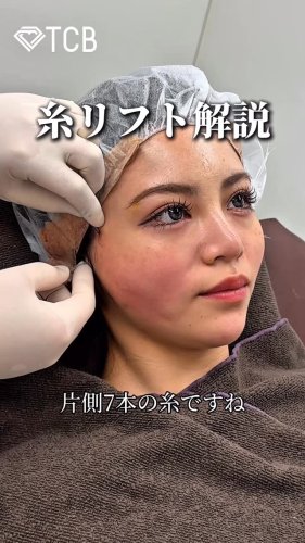 Video post from tcb_omi.