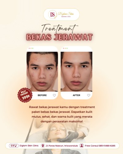 PostPhoto