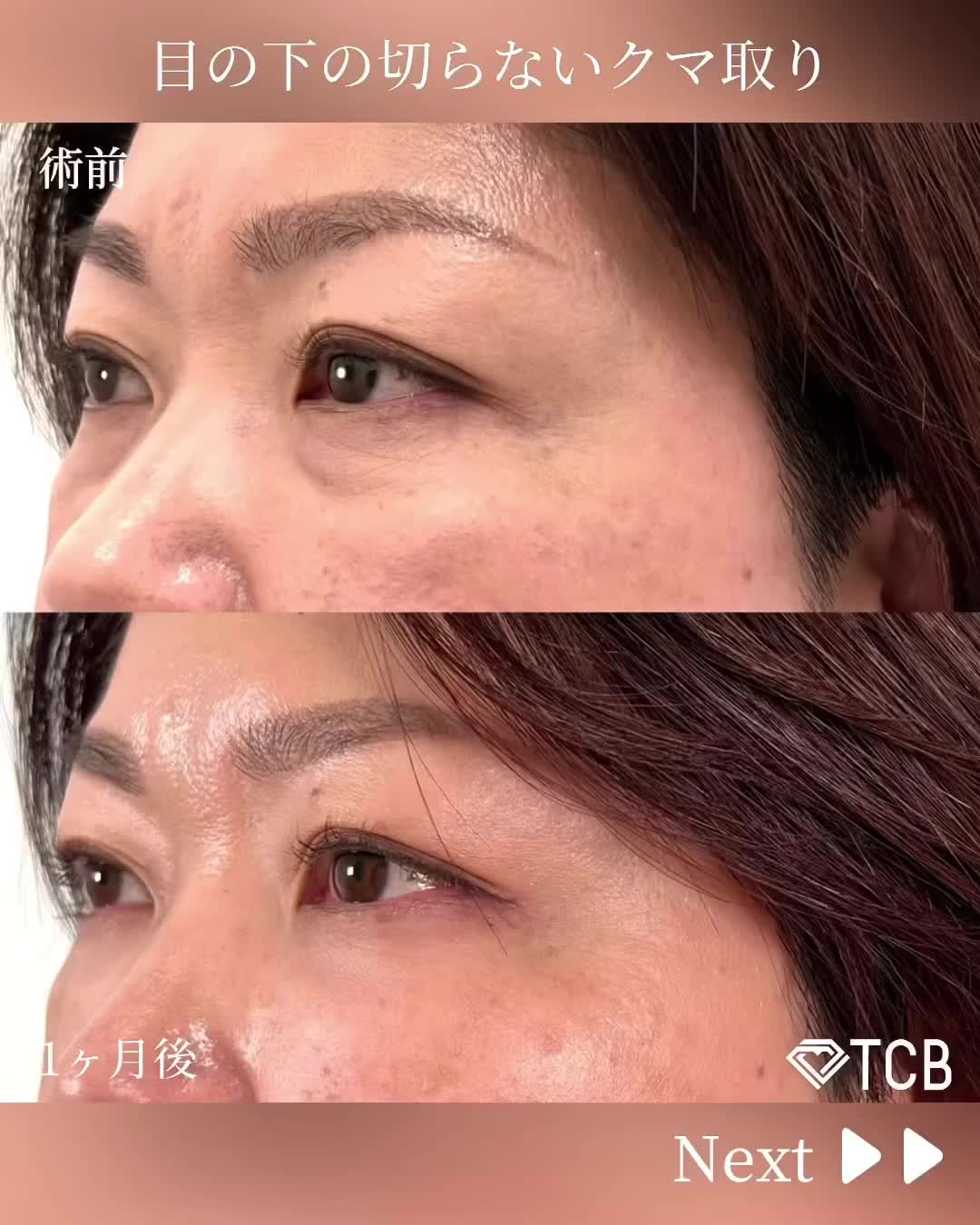 Carousel post from tcb_sano_eiki_.