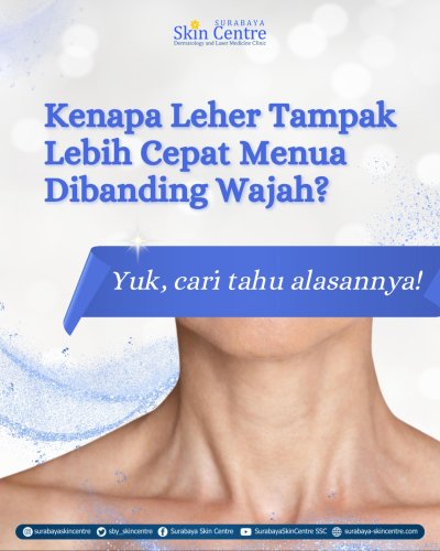 PostPhoto