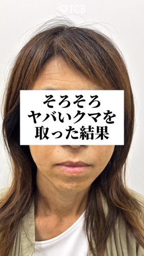 Video post from tcbdaisuke_shorei.