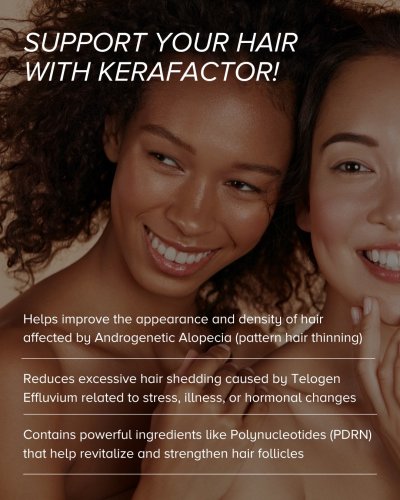 Photo post from kerafactor.