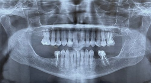 Photo post from trilliumdental.