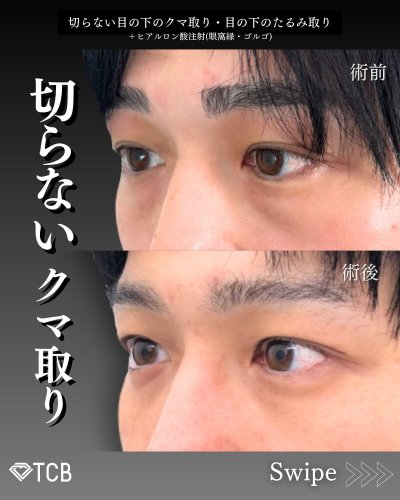 Carousel post from tcb_okuda_shingo.