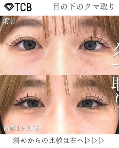 Carousel post from tcb_iwamoto.