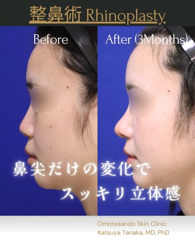 田中 克弥 医師 | 美容外科・美容皮膚科なら表参道スキンクリニック