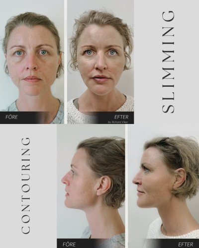 Photo post from Vikor Klinik.