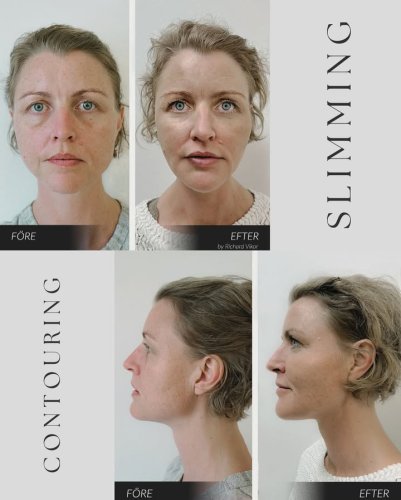 Photo post from Vikor Klinik.