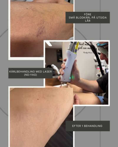Photo post from Vikor Klinik.