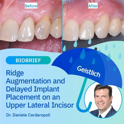 Carousel post from Geistlich Biomaterials - North America.