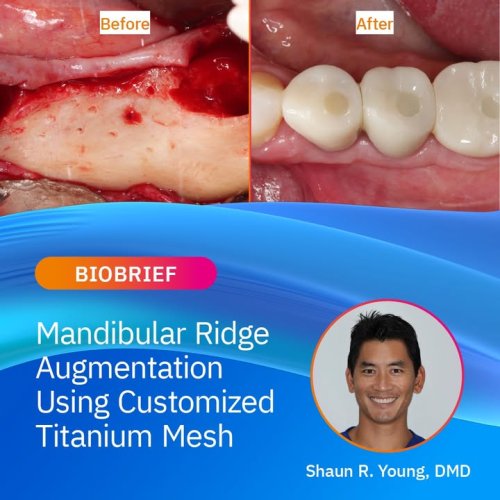 Carousel post from Geistlich Biomaterials - North America.
