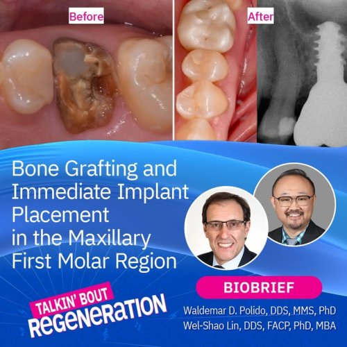Carousel post from Geistlich Biomaterials - North America.