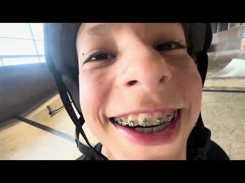 Video post from NKD Scooters.