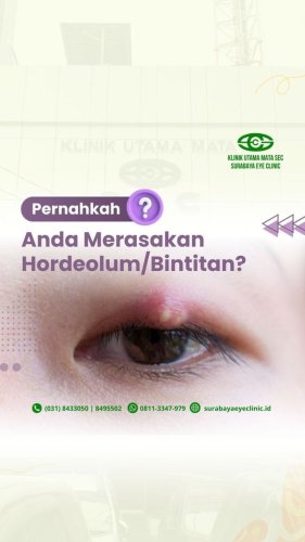 PostPhoto