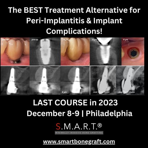 Photo post from smartbonegraft.