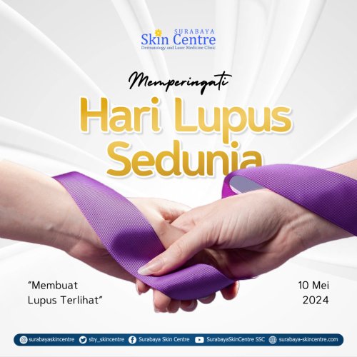 PostPhoto