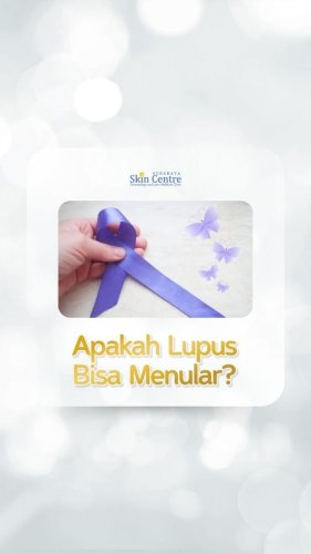 PostPhoto