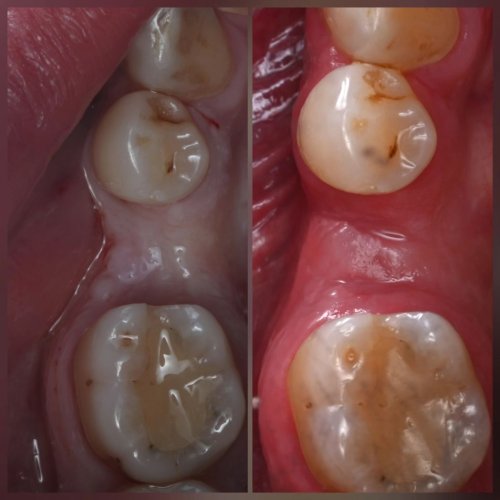 Carousel post from mohammed.__.alrubaie.