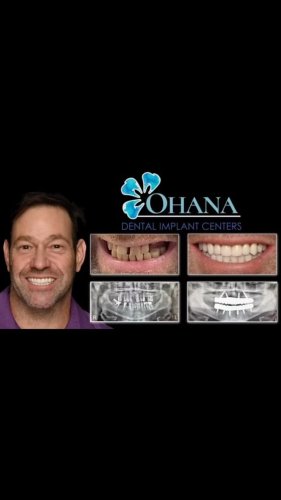 Video post from drsionamotufau.