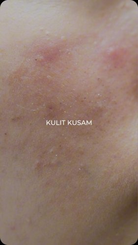 PostPhoto