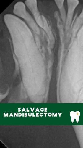 Video post from toothy.thomson.