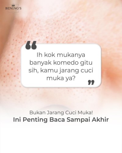 PostPhoto