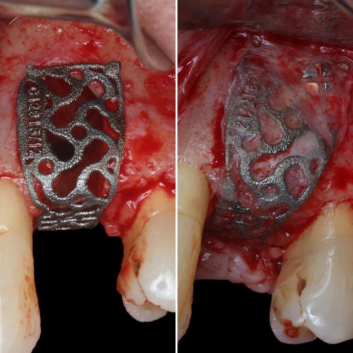 Carousel post from implantperiova.