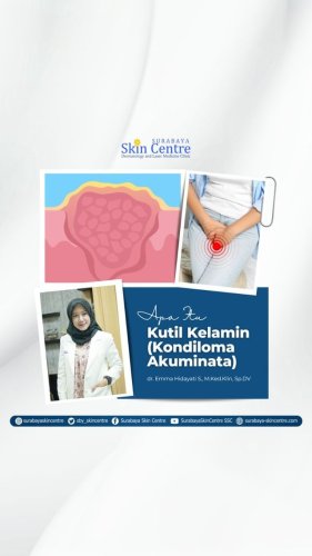 PostPhoto