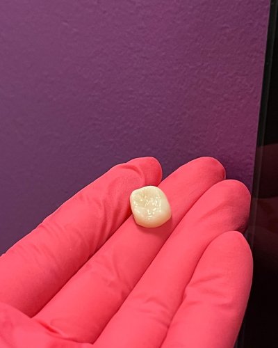 Photo post from trilliumdental.