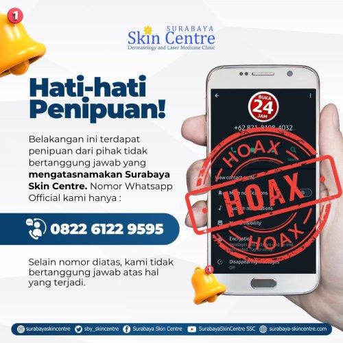 PostPhoto