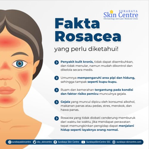 PostPhoto