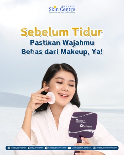 PostPhoto