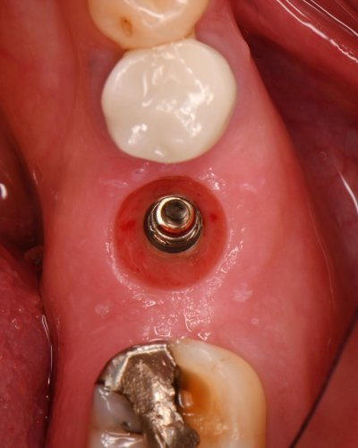 Carousel post from greenwichoralsurgery.