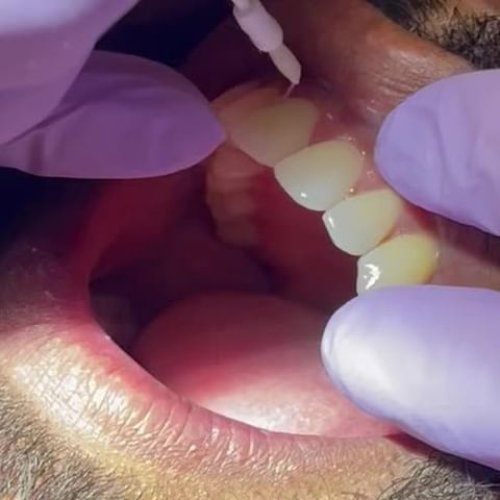 Video post from trilliumdental.
