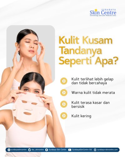 PostPhoto