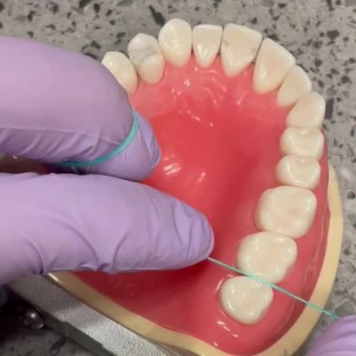 Video post from trilliumdental.